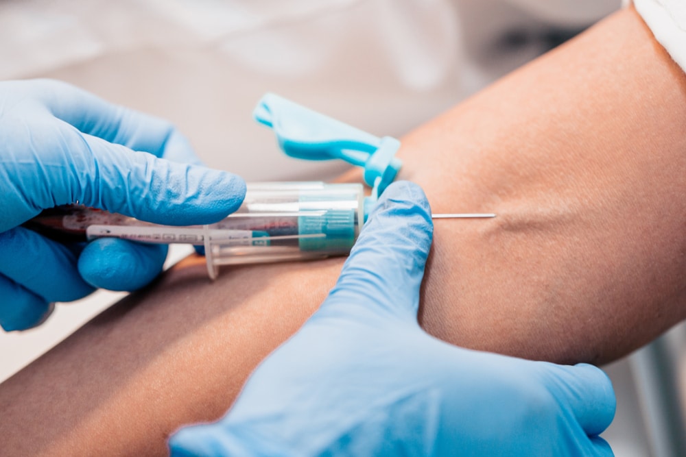 What is Phlebotomy, and Why Might You Need It? Orion Pharmacy Explains